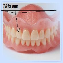 Any of You Know Shit About Teeth? 1310