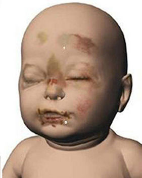 Baby P..............killed by mother and boyfriend 58267_10