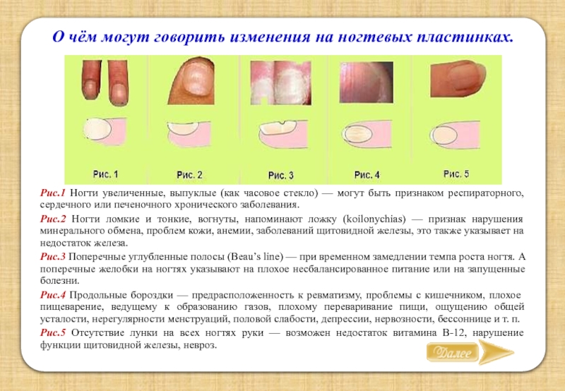 12 проблем с ногтямм Cd178b10