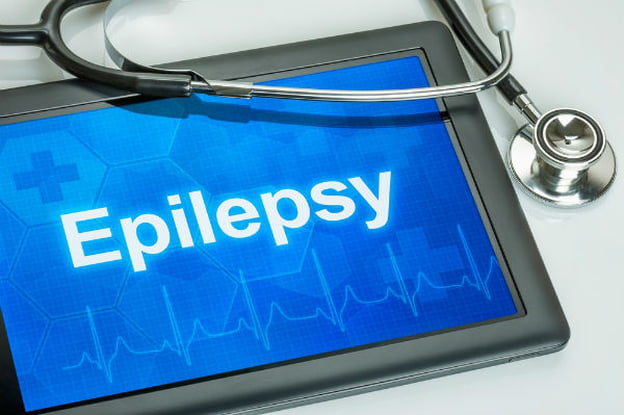 نوبة صرع Epileptic seizure 10879413