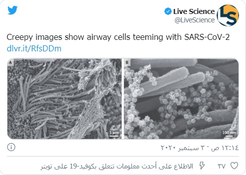 صور مخيفة تظهر خلايا مجرى الهواء تعج بفيروس SARS-CoV-2! Sars-c10