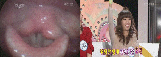 [SISTAR] SISTAR Hyorin’s vocal cords are most strained amongst female idols 20110217