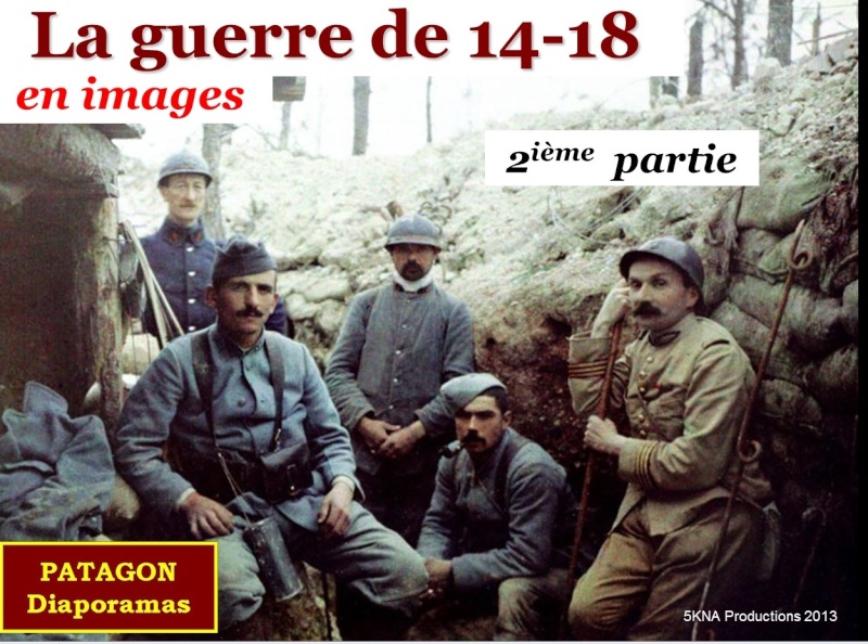 Photos inédites de la Première Guerre Mondiale. 14_18_10