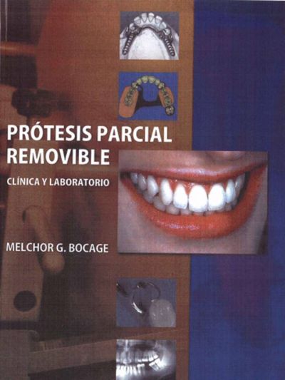 Prótesis parcial removible Bocage10