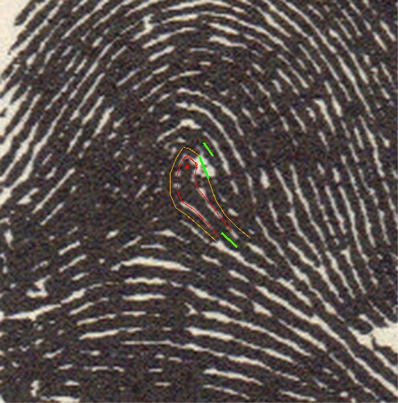 X - WALT DISNEY - One of his fingerprints shows an unusual characteristic! Walt-d17