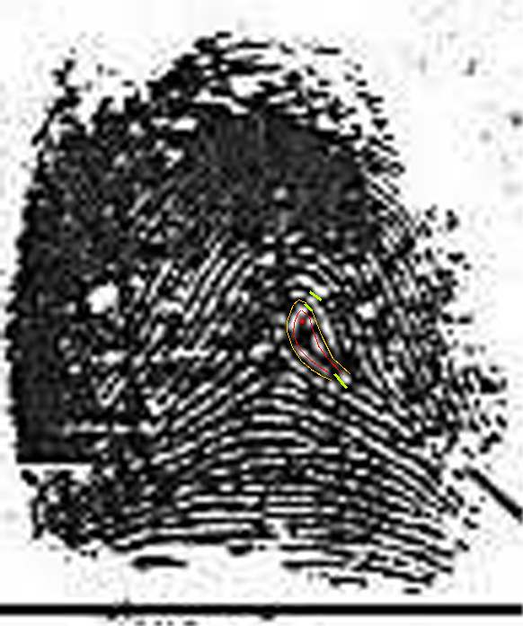 X - WALT DISNEY - One of his fingerprints shows an unusual characteristic! Walt-d19