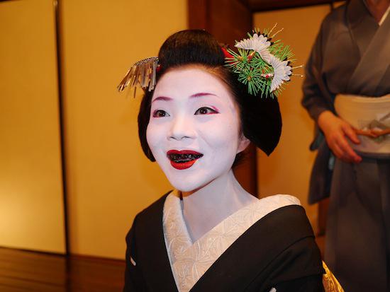 Les dents noircies, un signe de beauté traditionnel japonais D48bc710