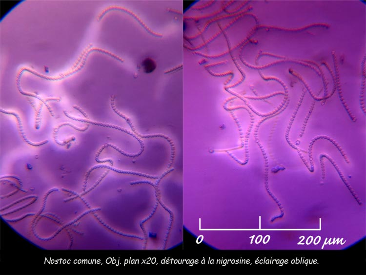Cyanobactérie : Nostoc commune Vauch. Ex Born & Flash 03_15410