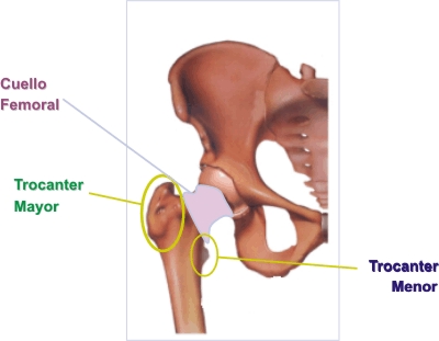 Osteoporosis, ms sobre esta enfermedad Cabeza10