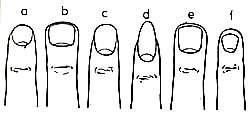 Forme de la main et La forme des ongles Main810