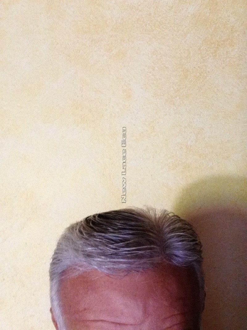 Foto Leontino con nuevo sistema de cabellos. Leonti11