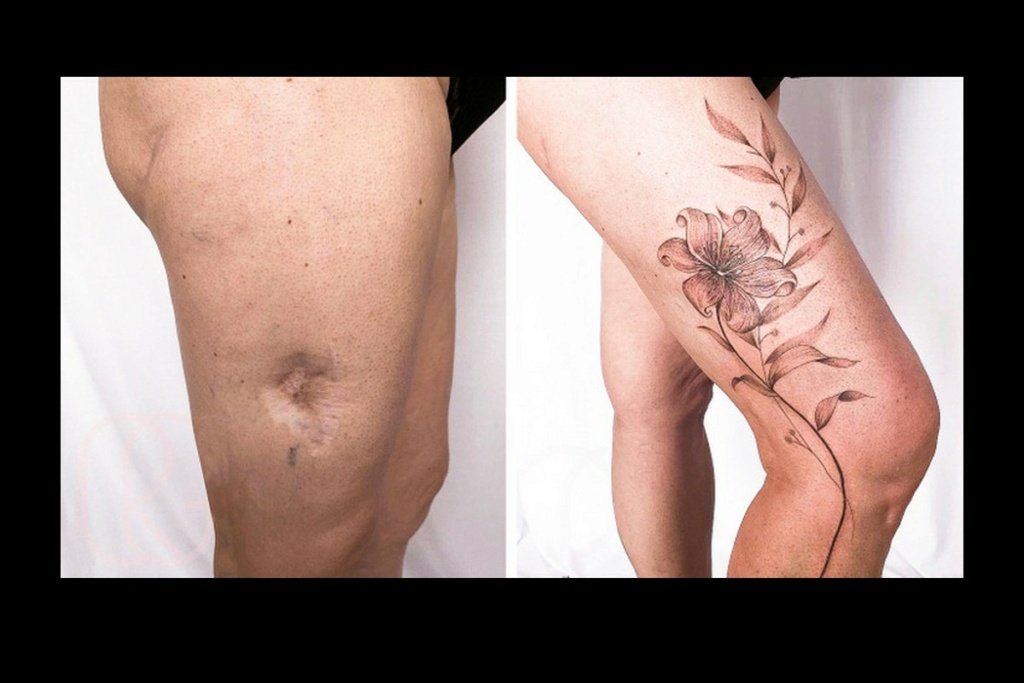 Une artiste réalise des tatouages sur des cicatrices afin que les personnes puissent s’en vanter 380