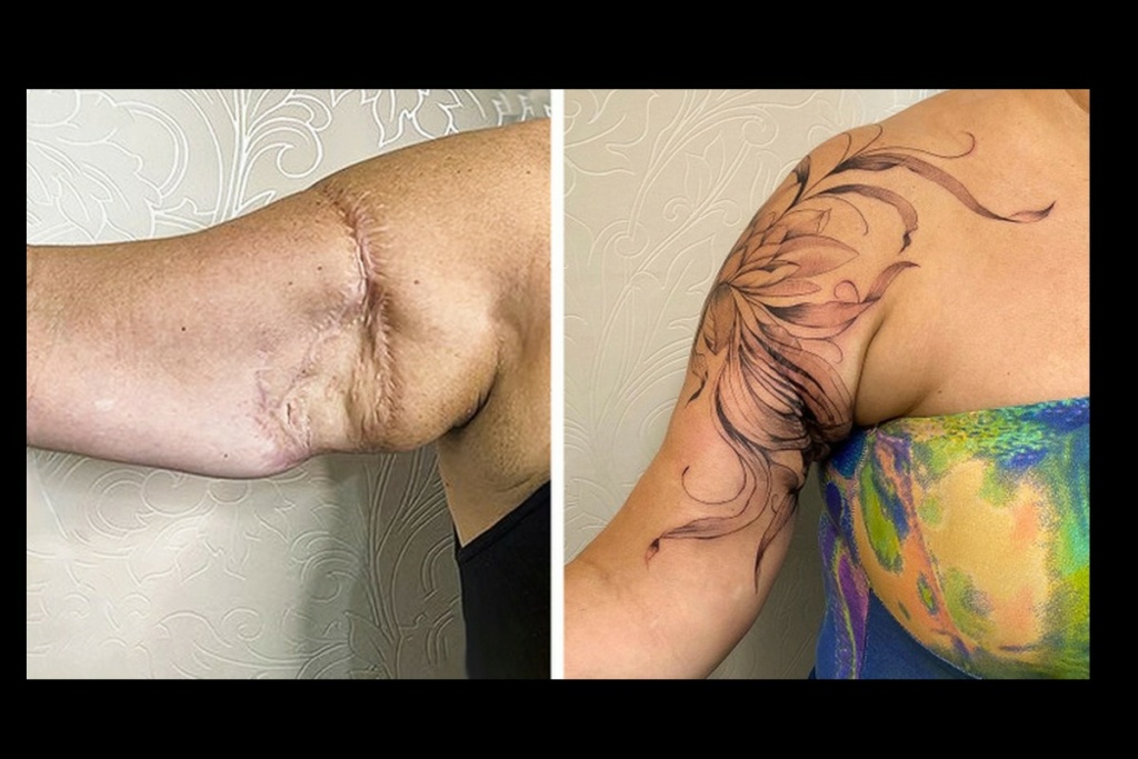 Une artiste réalise des tatouages sur des cicatrices afin que les personnes puissent s’en vanter 381