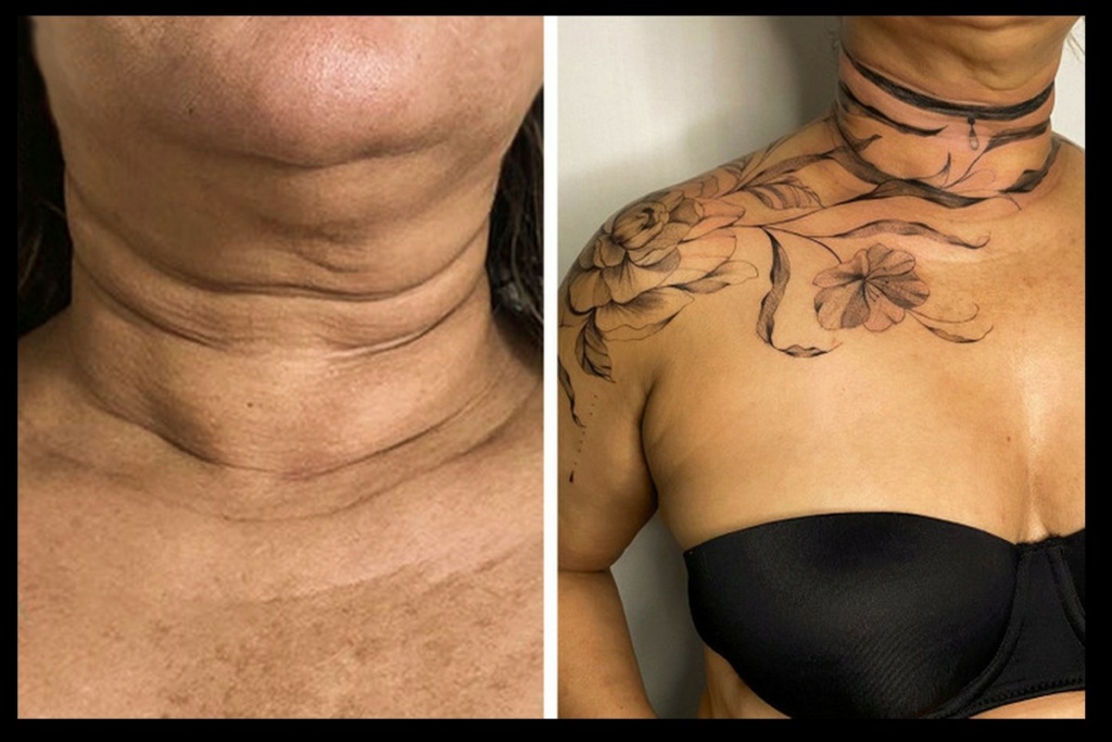 Une artiste réalise des tatouages sur des cicatrices afin que les personnes puissent s’en vanter 389