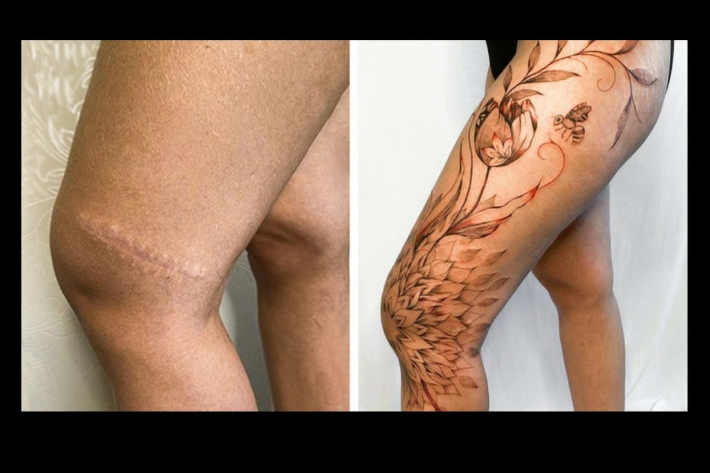 Une artiste réalise des tatouages sur des cicatrices afin que les personnes puissent s’en vanter 391