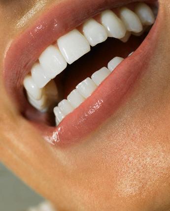 6 وصفات لتبييض الأسنان Oousus10
