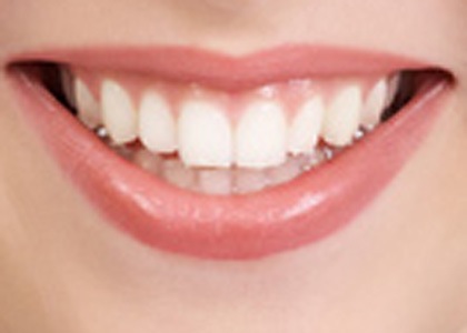بعض الطرق الطبيعية لتبييض الأسنان White-10