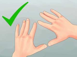 How to Cure Severely Chapped Hands Downlo10