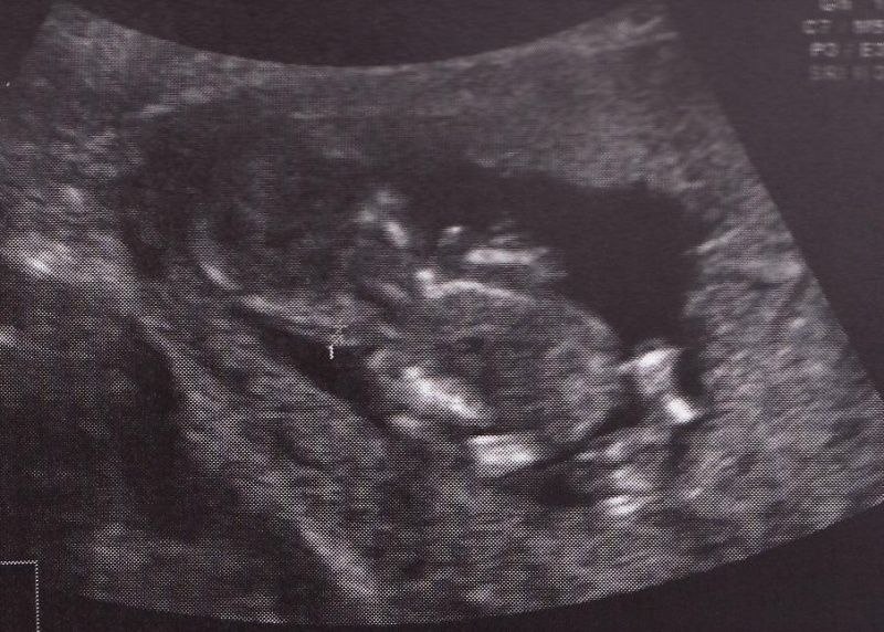 Galle: Ma 2me grossesse pour juin 2009 Bibou11