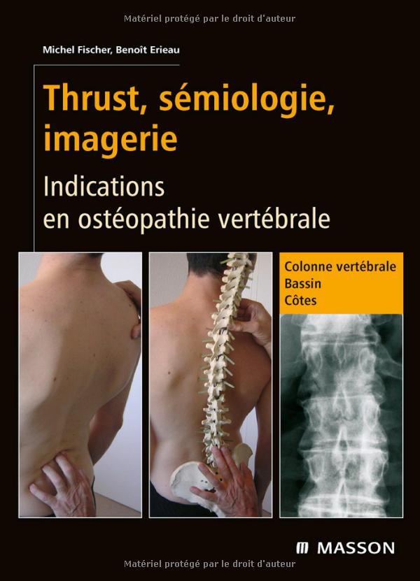 Thrust, sémiologie, imagerie : Indications en ostéopathie vertébrale   22947010