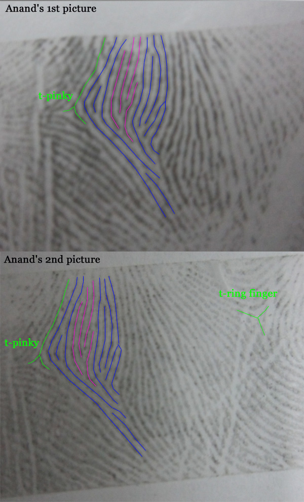 Is this a comb pattern or no pattern in mercury mount - Page 2 Anand-12