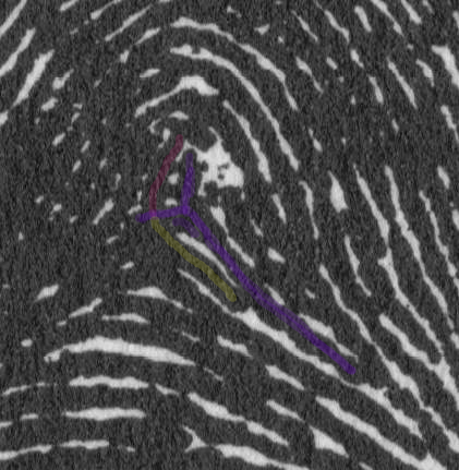 X - WALT DISNEY - One of his fingerprints shows an unusual characteristic! - Page 3 Disney13