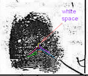 X - WALT DISNEY - One of his fingerprints shows an unusual characteristic! - Page 2 Exampl19