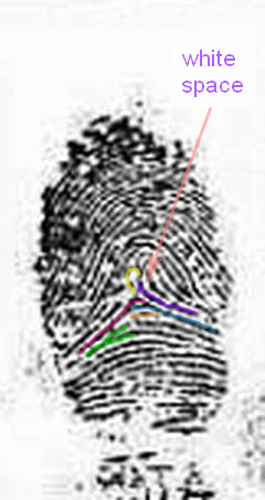 X - WALT DISNEY - One of his fingerprints shows an unusual characteristic! - Page 2 Exampl20