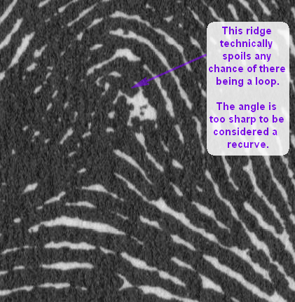 X - WALT DISNEY - One of his fingerprints shows an unusual characteristic! - Page 4 No_rec10