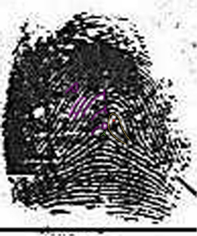 X - WALT DISNEY - One of his fingerprints shows an unusual characteristic! Patti10
