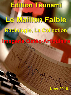 Maillon Faible Radiologie 10021110