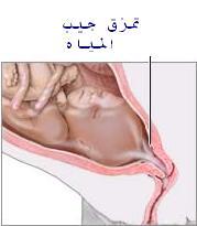 رحلة الأم و....الجنين..!! 4545710