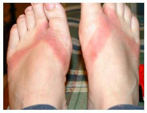Be careful of your flip flops (Toxic materials from china) Flip_210