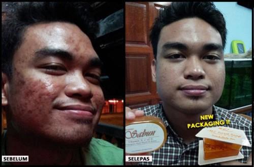 Testimoni Pengguna Sabun Vitamin A, C & E Sabun-14