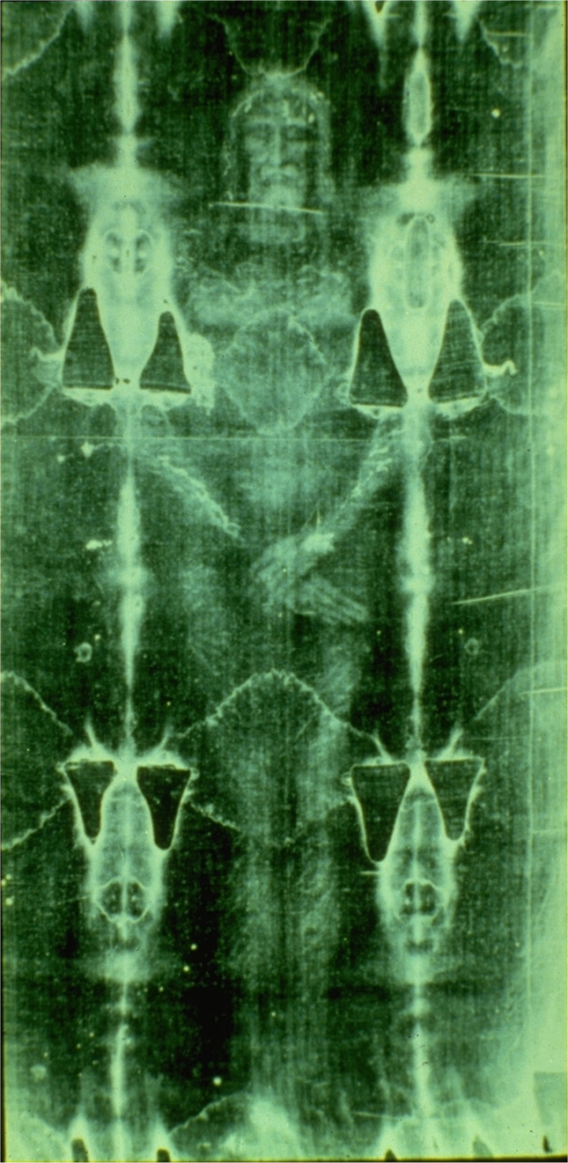 The Shroud of Turin:  Christ's Evidence of the Resurrection - Page 3 11b_ti11