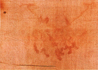 The Shroud of Turin:  Christ's Evidence of the Resurrection - Page 3 12b_ti11