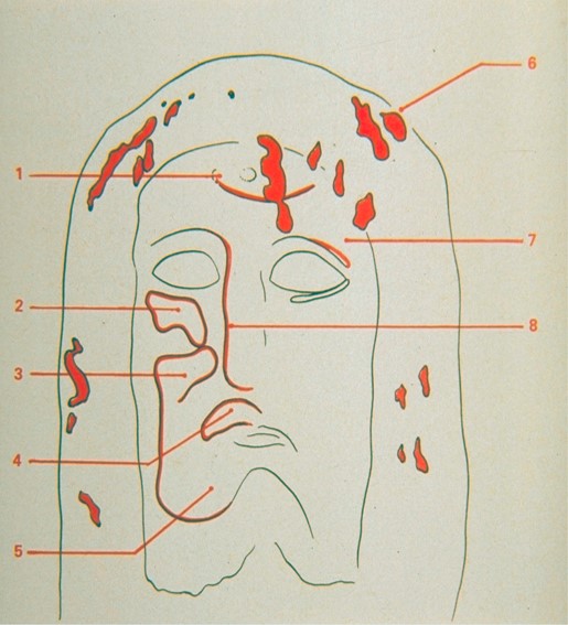 The Shroud of Turin:  Christ's Evidence of the Resurrection - Page 3 13f10