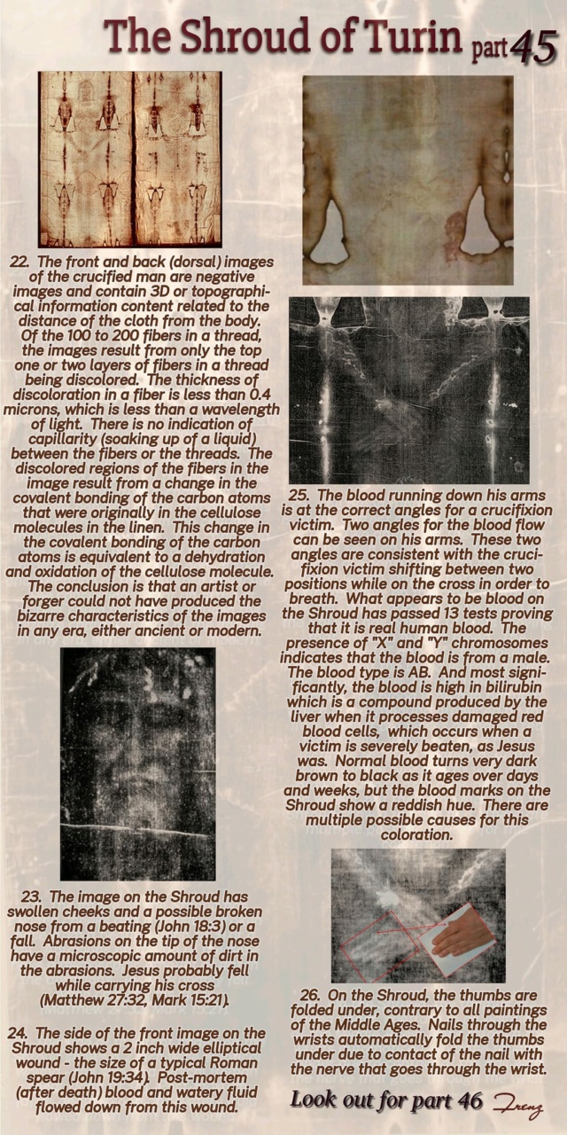 The Shroud of Turin:  Christ's Evidence of the Resurrection - Page 2 32711510