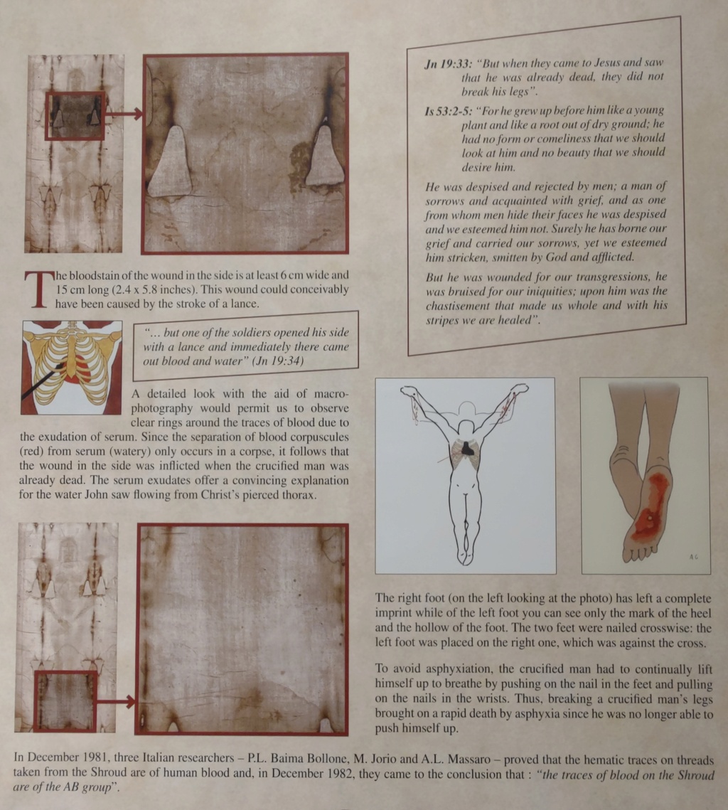 The Shroud of Turin:  Christ's Evidence of the Resurrection - Page 3 720