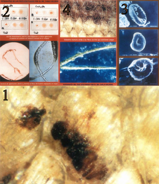 The Shroud of Turin:  Christ's Evidence of the Resurrection Blood_11