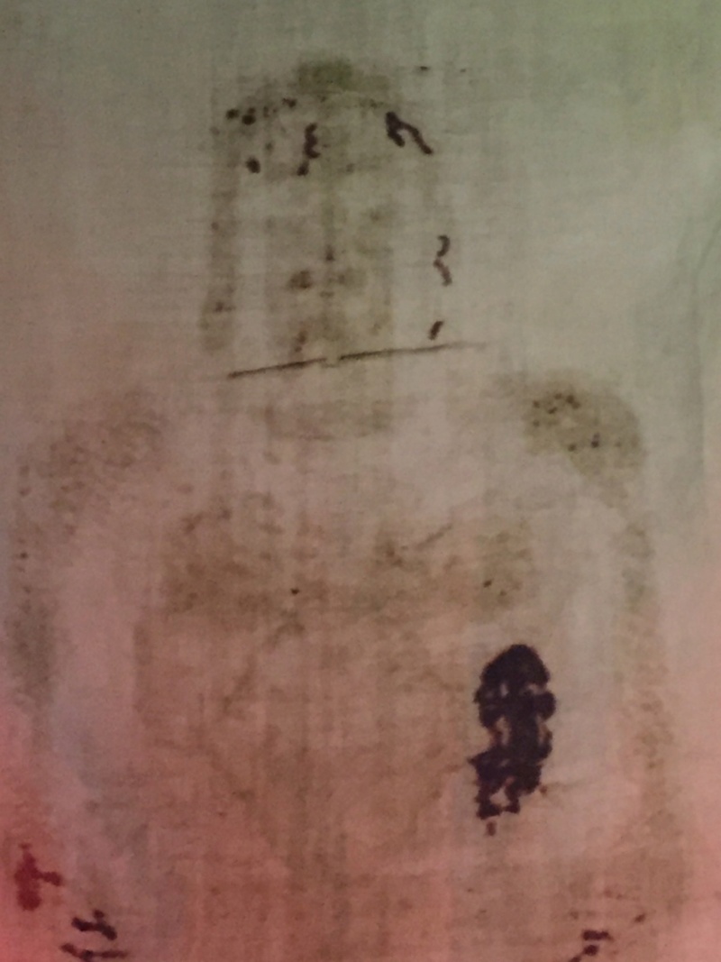 The Shroud of Turin:  Christ's Evidence of the Resurrection - Page 2 C_9p7d10