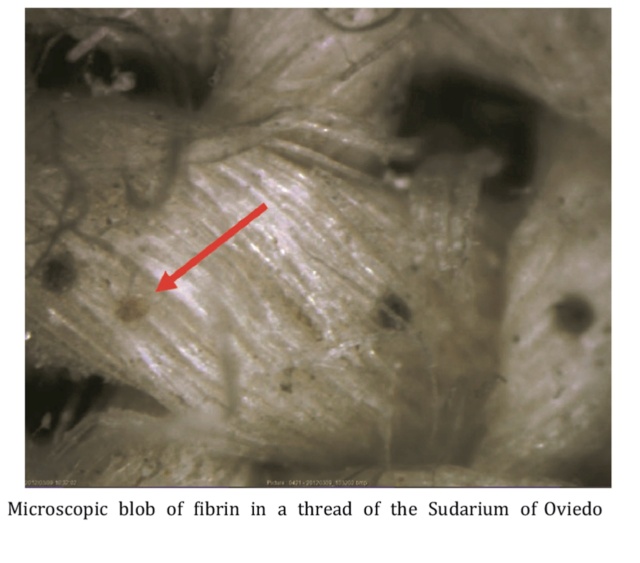 From Forensics to Faith: The Shroud of Turin's History and Authenticity Under Scrutiny - Page 2 G3401_11