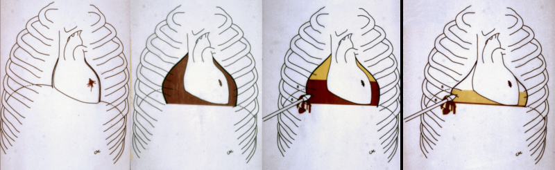 The Shroud of Turin:  Christ's Evidence of the Resurrection - Page 3 G519810