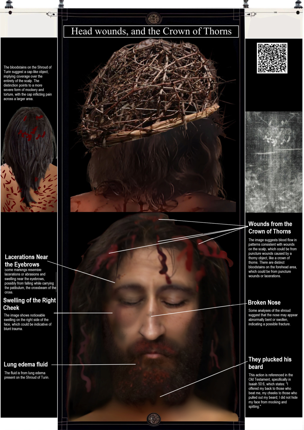 The Shroud of Turin:  Christ's Evidence of the Resurrection - Page 4 Panel_51