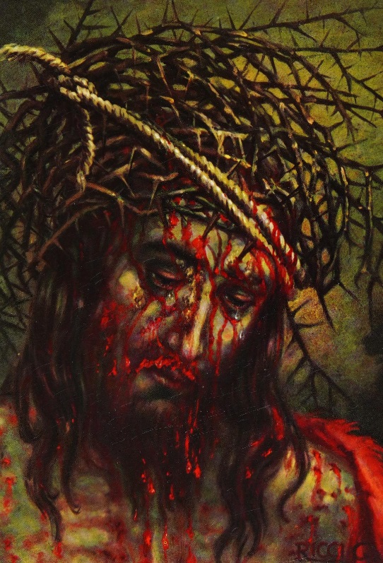 The Shroud of Turin:  Christ's Evidence of the Resurrection Sem_t160