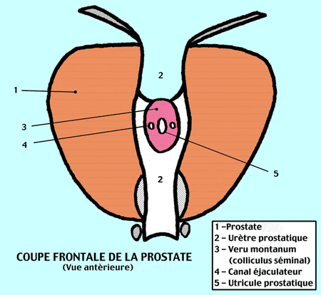 Utricule prostatique  Unname10