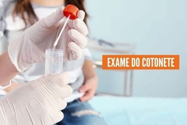 Como funciona o exame do cotonete? O-que-12