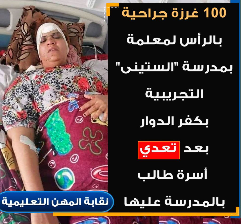 100 غرزة جراحية بالرأس لمُعلمة بمدرسة "الستينى" التجريبية بكفر الدوار بعد تعدى أسرة طالب عليها 5216