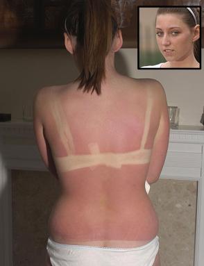 Girl (14) burned in tanning machine 0907_b10