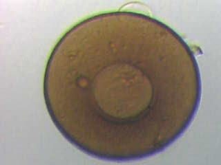 microscopie Amibe117